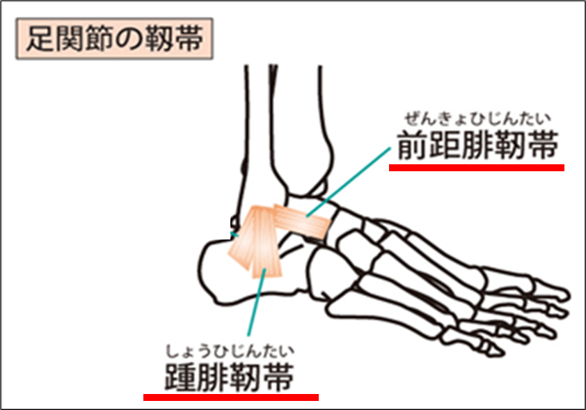 足関節捻挫の好発部位